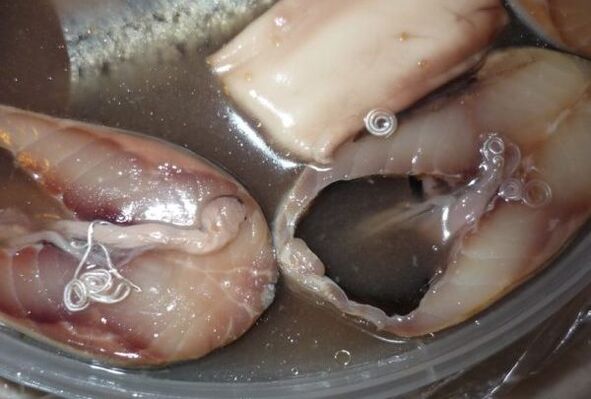 Voies d'infection humaine par les parasites.