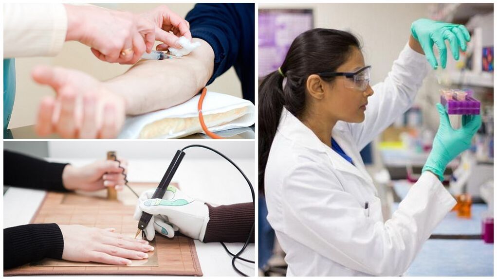 Méthodes de diagnostic pour détecter les parasites dans le corps.