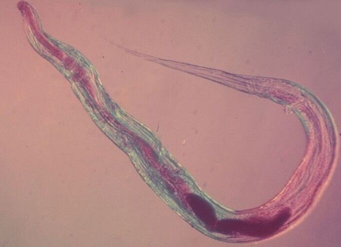 Les oxyures au microscope